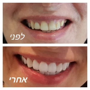 pixlr_20181122162348748