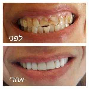 pixlr_20190512172647474