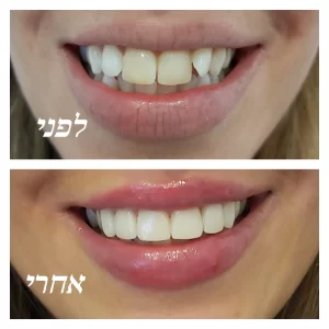 pixlr_20190831120739522