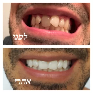 pixlr_20190930210806165