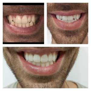 pixlr_20200116164823090