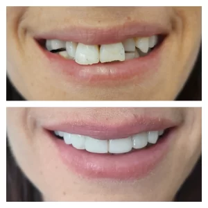 pixlr_20200116165912892