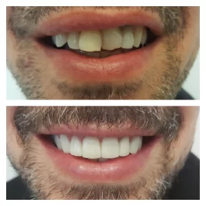 pixlr_20200130164616335