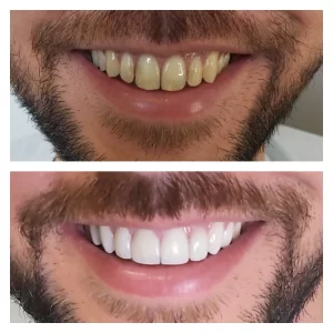 pixlr_20210406090704148