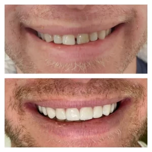 pixlr_20210406114615486